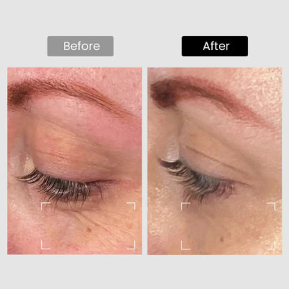 DermRays Revive Skincare Laser for Anti-Aging, Glow Like Never Before