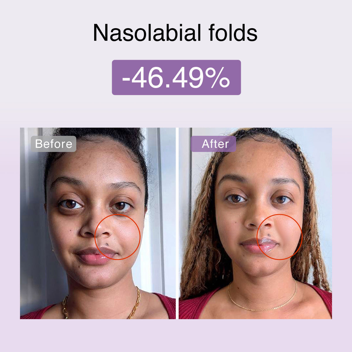 DermRays FusionGlow Multi-Functional Microcurrent Facial Toning Device