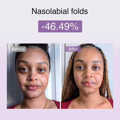 DermRays FusionGlow Multi-Functional Microcurrent Facial Toning Device