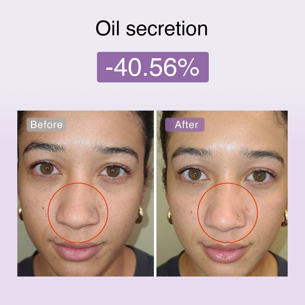 DermRays FusionGlow Multi-Functional Microcurrent Facial Toning Device