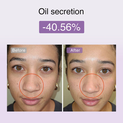 DermRays FusionGlow Multi-Functional Microcurrent Facial Toning Device