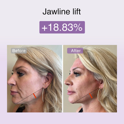 DermRays FusionGlow Multi-Functional Microcurrent Facial Toning Device